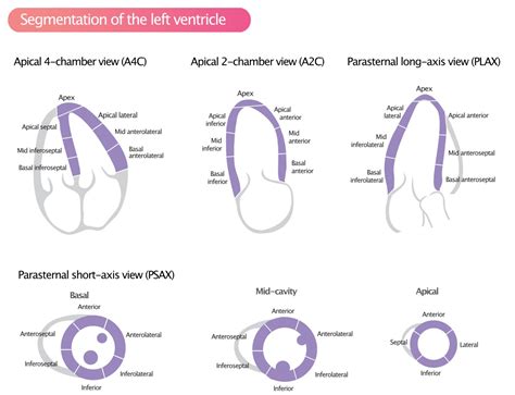 cardiac regional wall motion abnormalities.